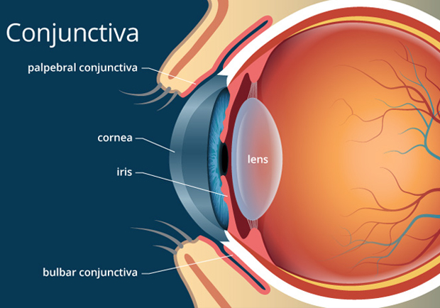 Best Eye Hospital in Bangalore for Cataract Operation